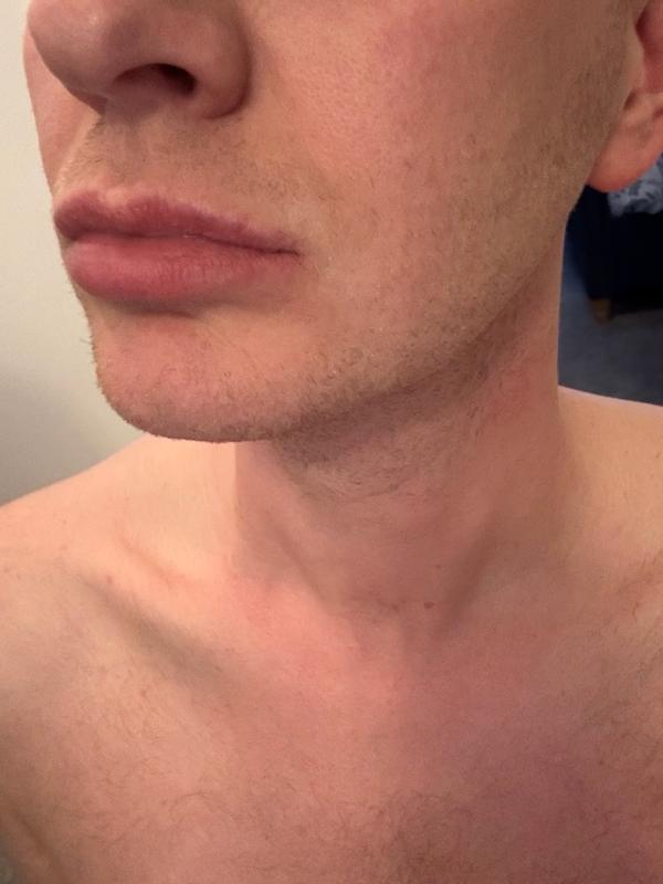 User generated review image 3