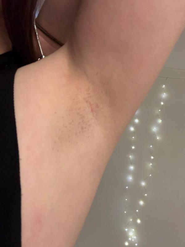 User generated review image 3