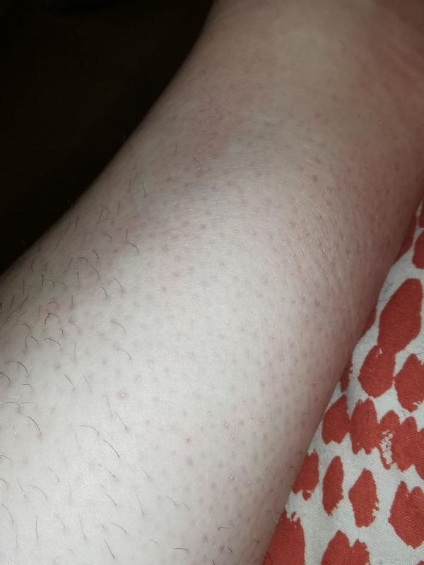 User generated review image 3