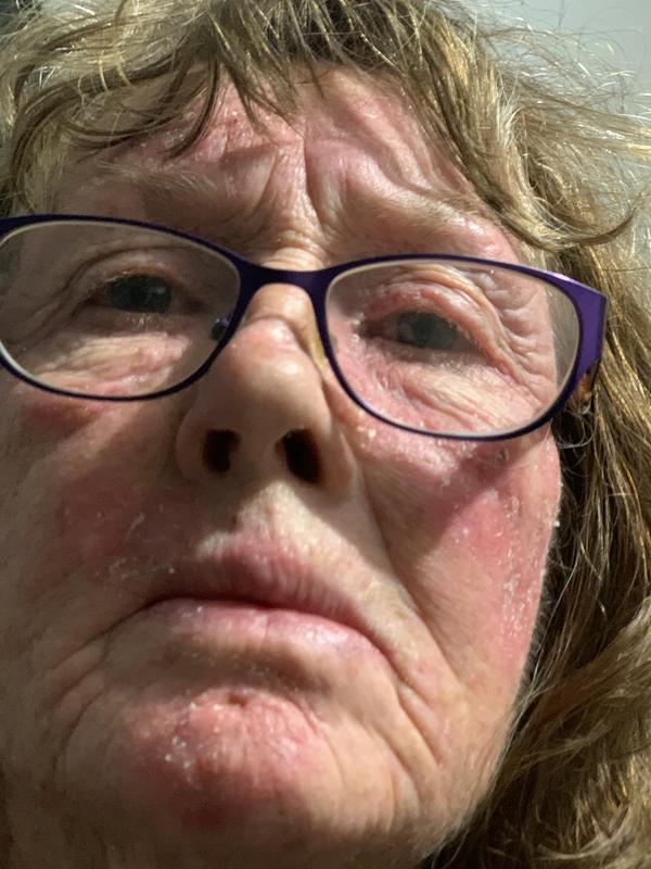 This is my skin after using your product!🤷‍♀️