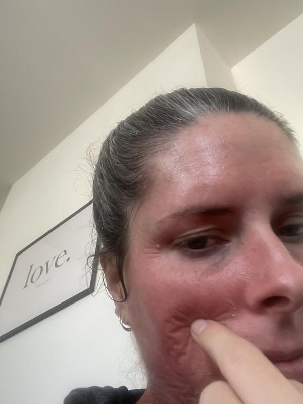 Not “hydrated” but ruined