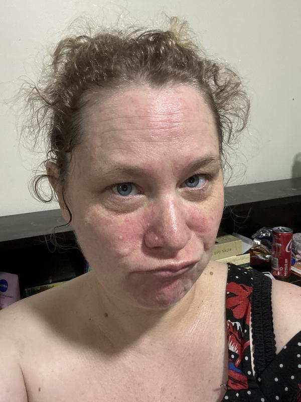 Red face