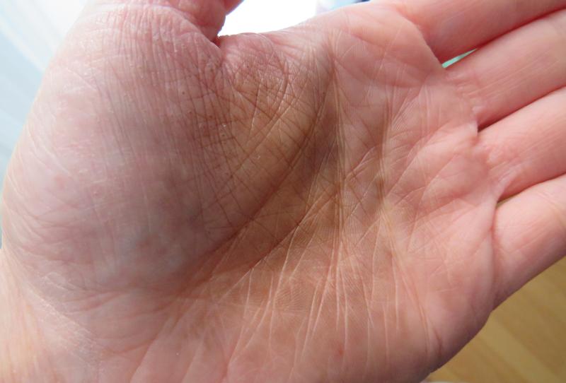 Handfärbung trotz Handschuhe (Ausnahme- ist zuvor noch nie passiert bei den Nutrisse Farben)