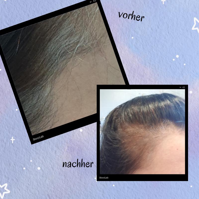 Vorher und Nachher