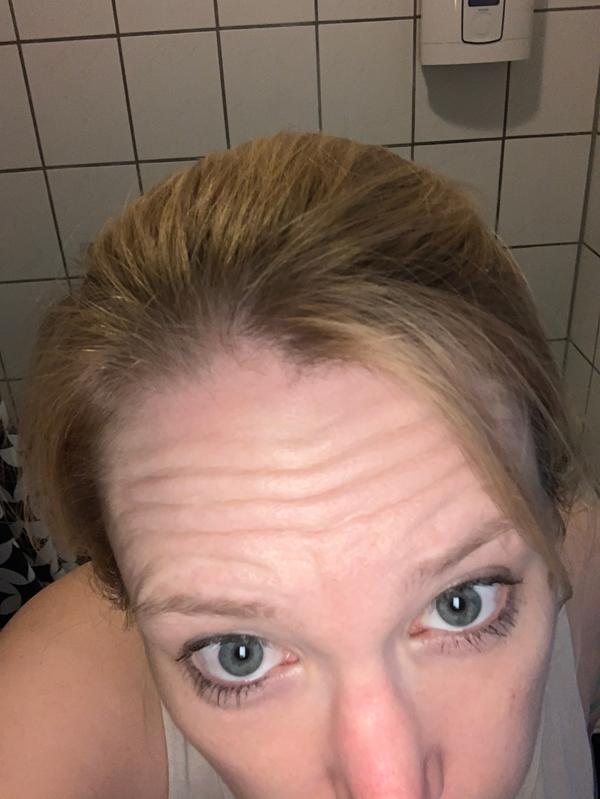 Vorher