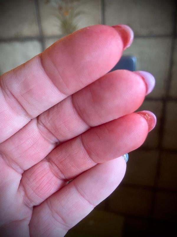 Rote Finger und Nägel