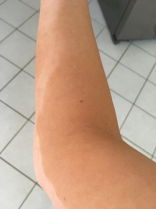 Wie bekomme ich das wieder ab?