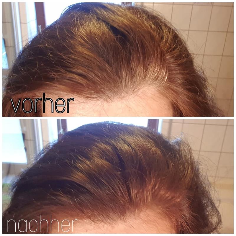Vorher- nachher