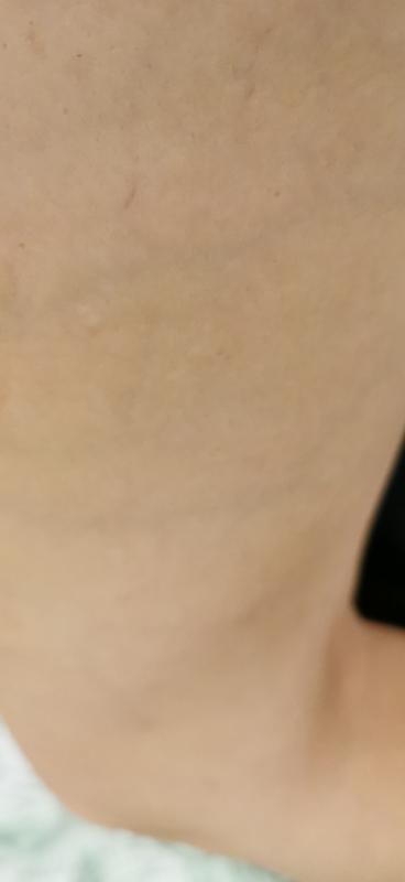 Näher, meine schöne Haut