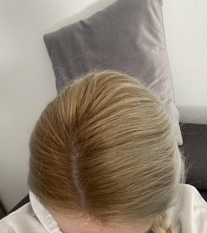 So sehen die Haare nach der verbesserten formel aus gar nicht schön. Beim ersten Foto diie alte formel super schön.