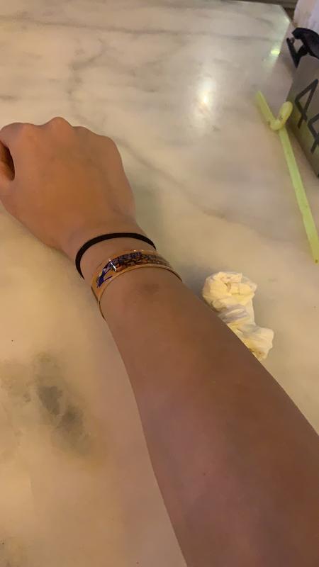 Nach nur einmal Sonnenbaden !