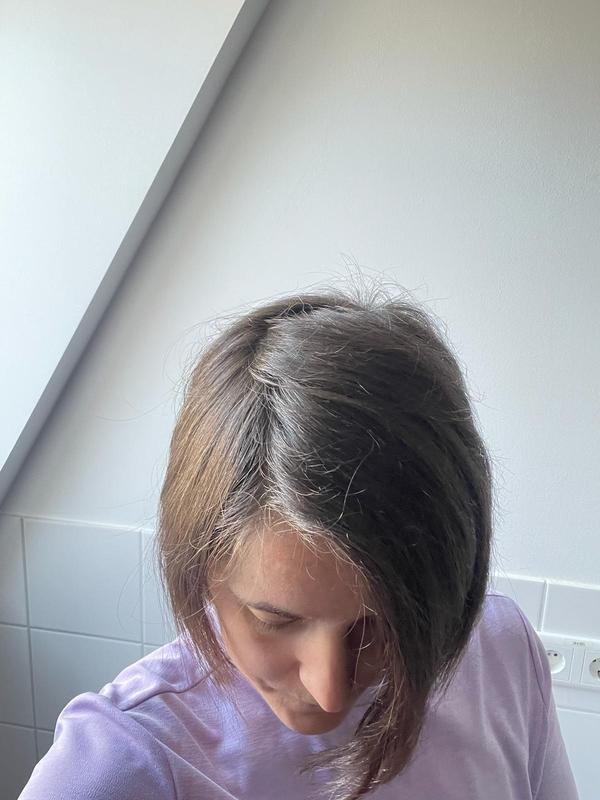 Vorher