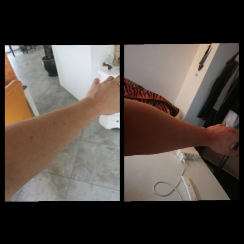 Besser / günstiger  und niee so Schädlich wie Solarium