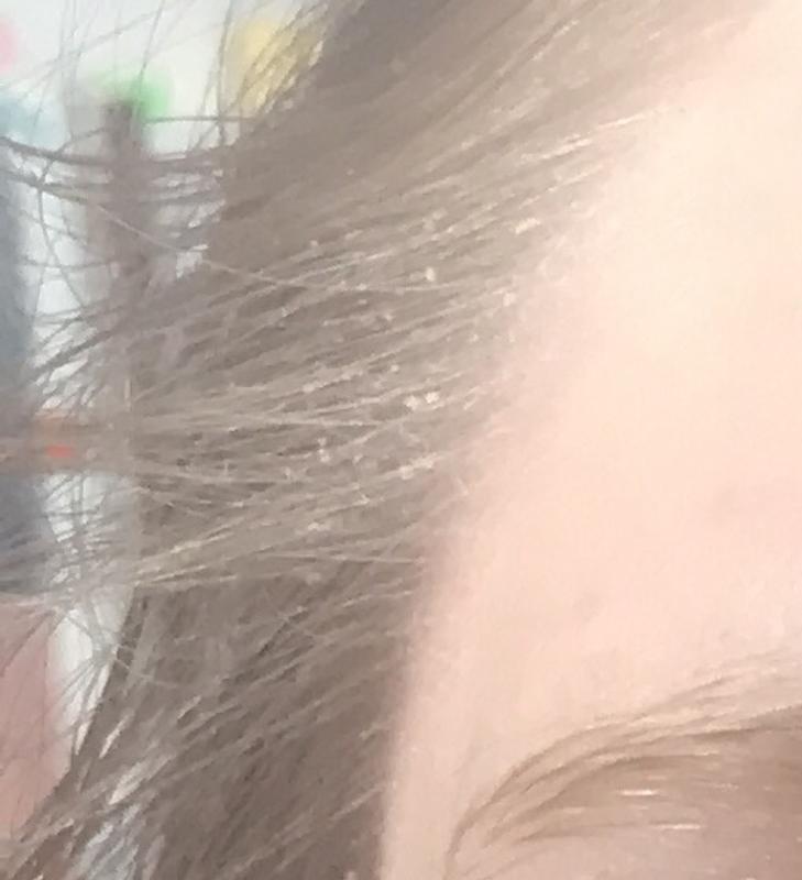 Klümpchen in den Haaren sieht doof aus und ist schwer zu entfernen. Auch relevant für Bartträger denke ich.