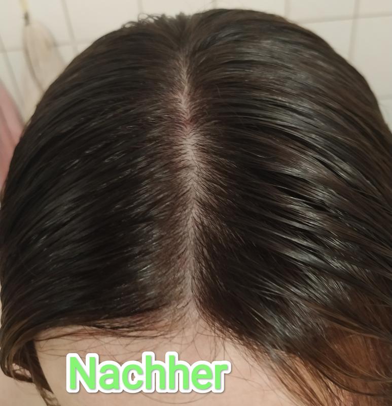 Nachher