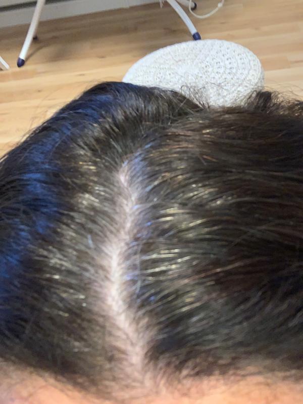 Meine grauen haare