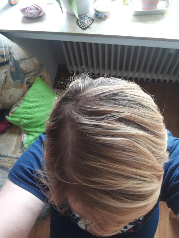 Vorher