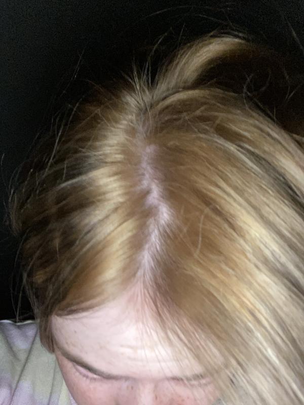 My hair now.