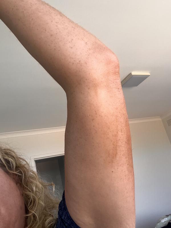 Looks like this all over my body and I made sure to cover every area