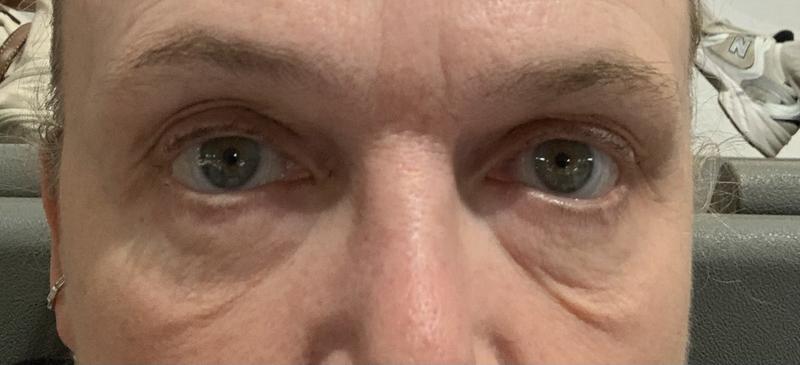 My eyes after using this product.