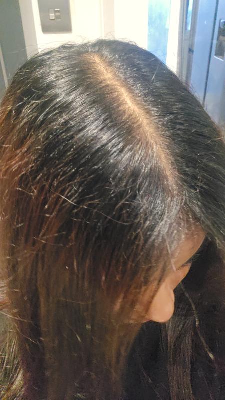 Overgrown roots