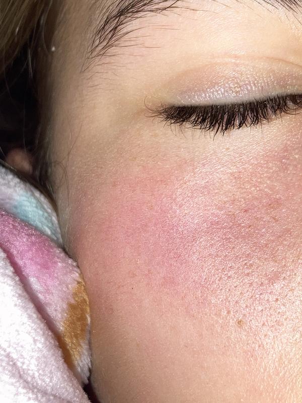 My skin after using this product