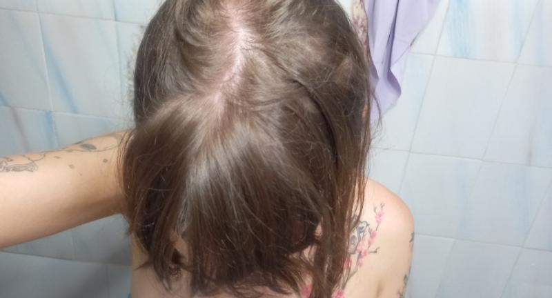 Cobertura raíz y canas