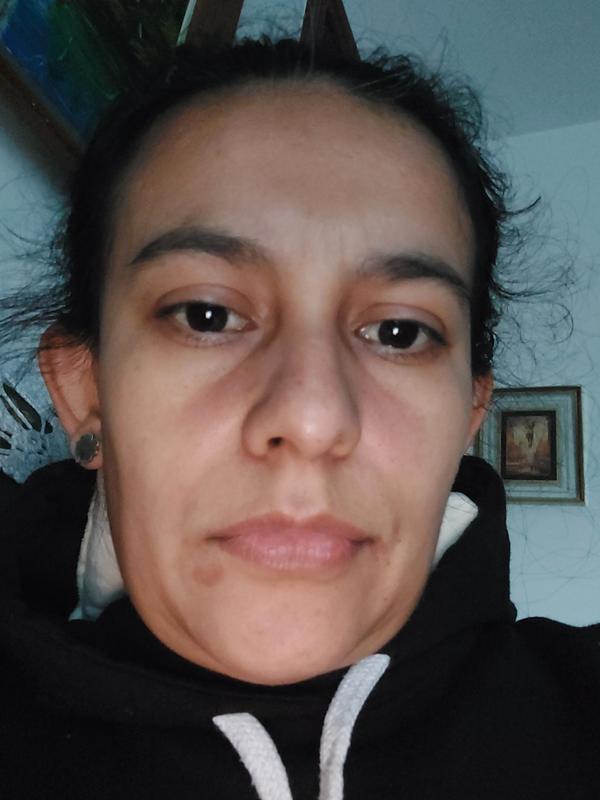 Alergia cara roja