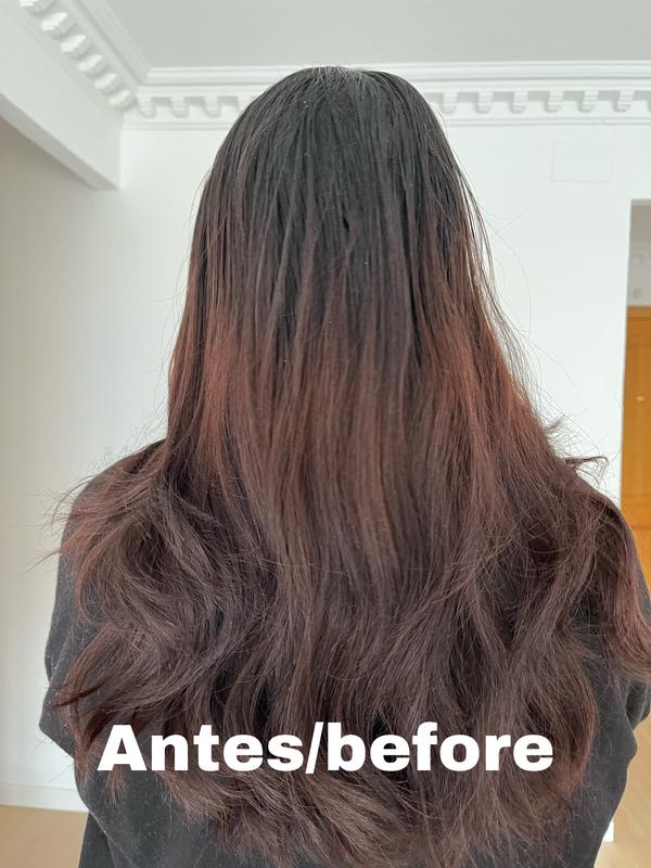 Antes