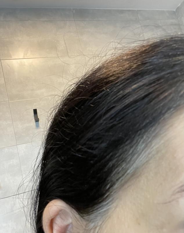 Antes