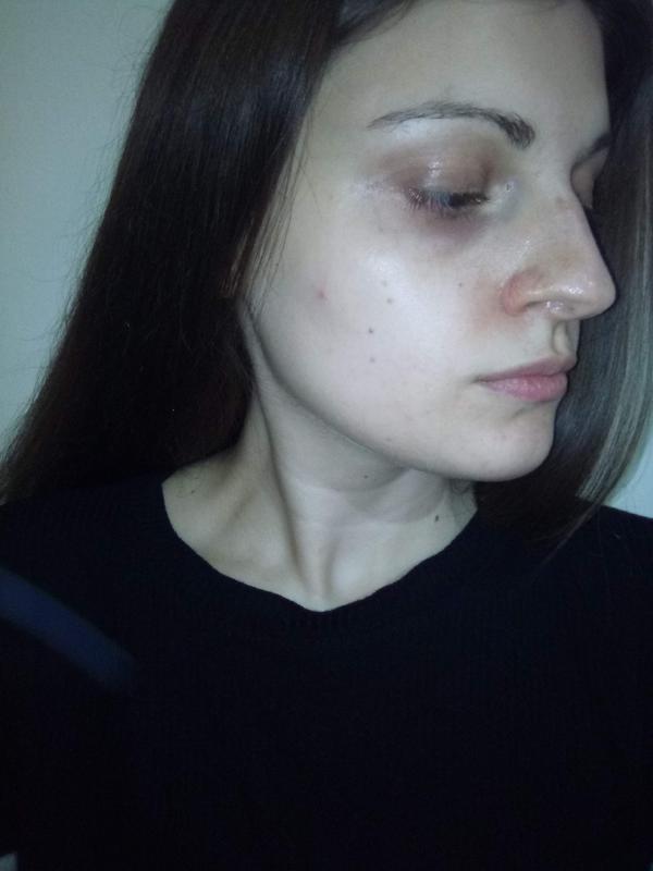 Segunda foto de mi otro perfil sin tratamiento