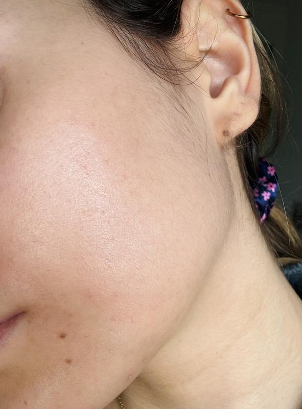 Before and After