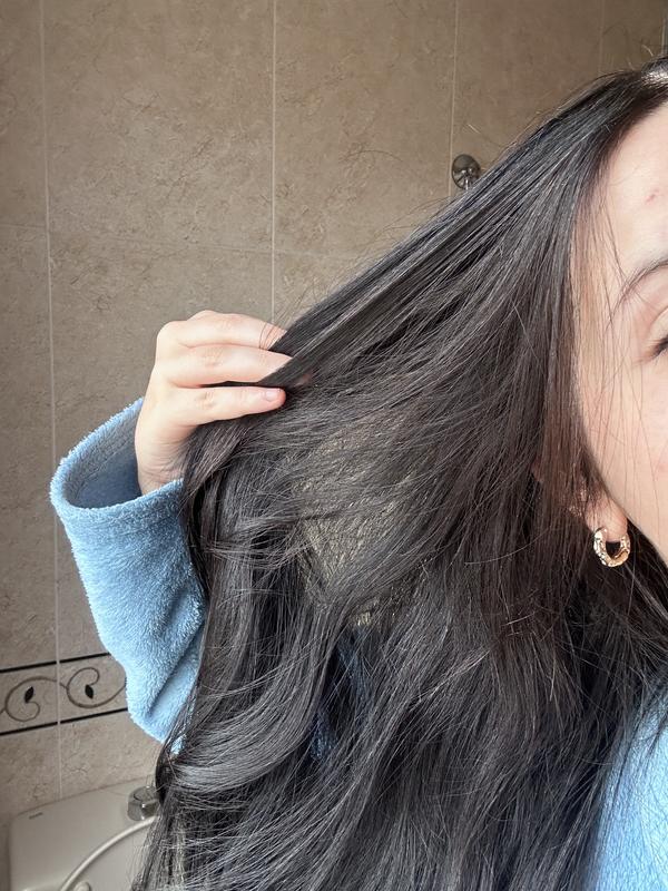 Antes