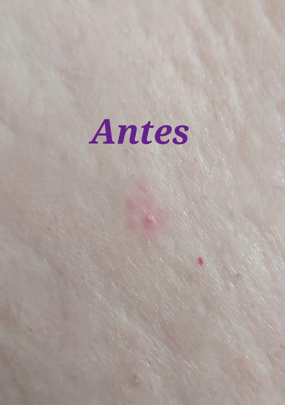 Foto 4 de la reseña.
