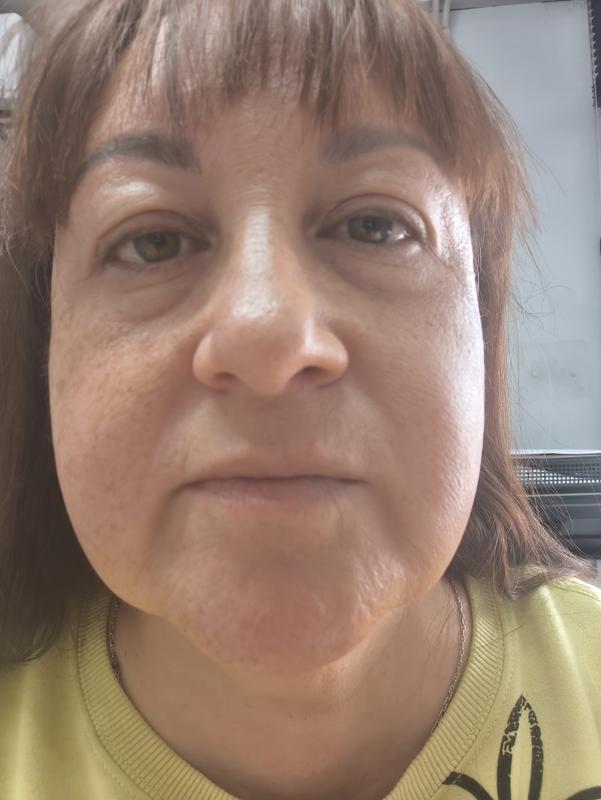 Mitad de cara con el fluido