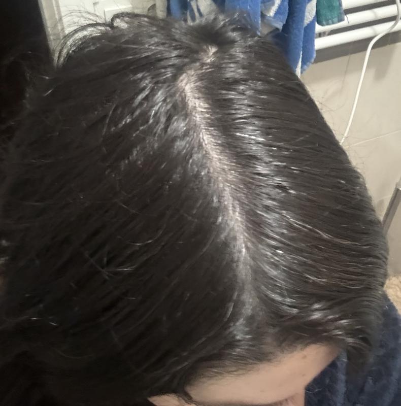 Antes