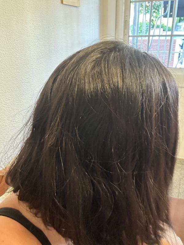 Antes