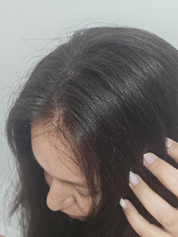 Antes