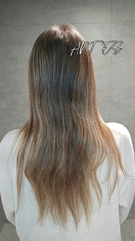 Antes