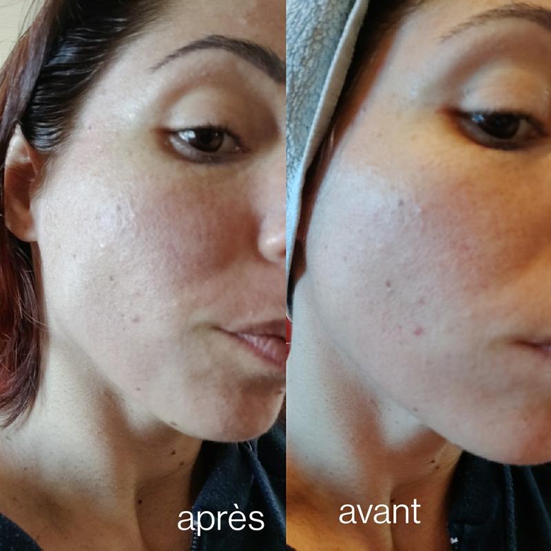 Teint plus lumineux et hydrater