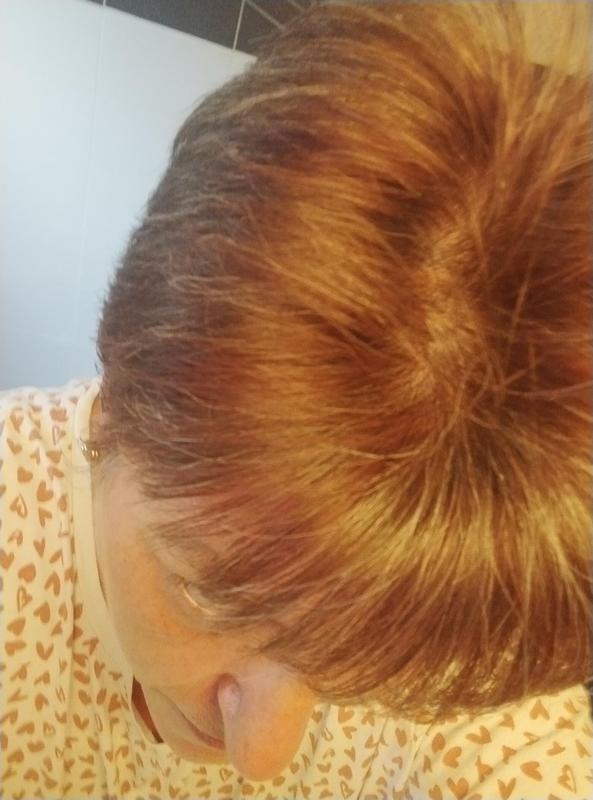 on voit encore plus mes cheveux blanc