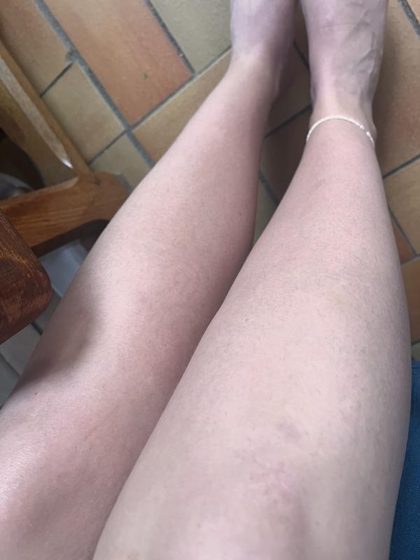 Avis sur la photo 1.