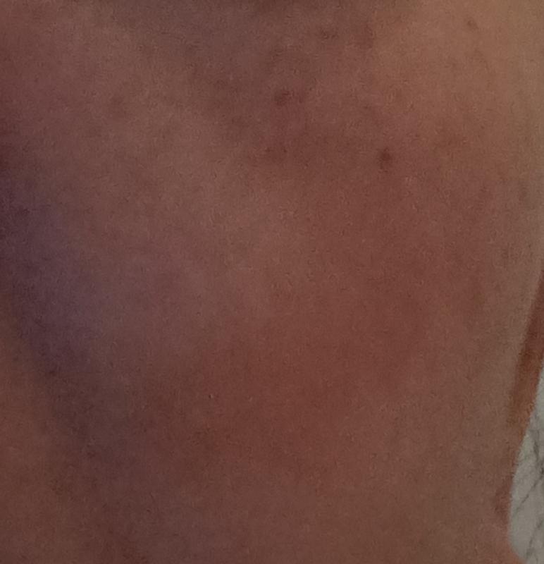 Avis sur la photo 6.