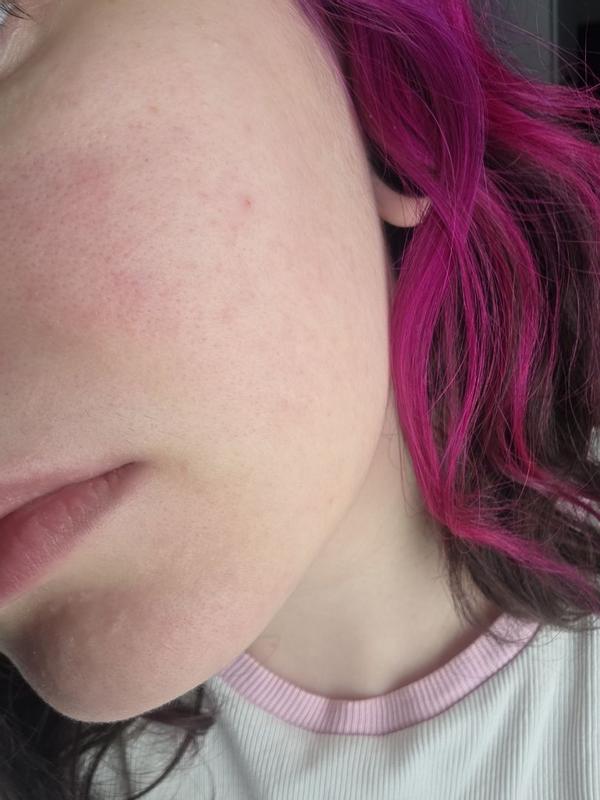Beoordeling foto 2.