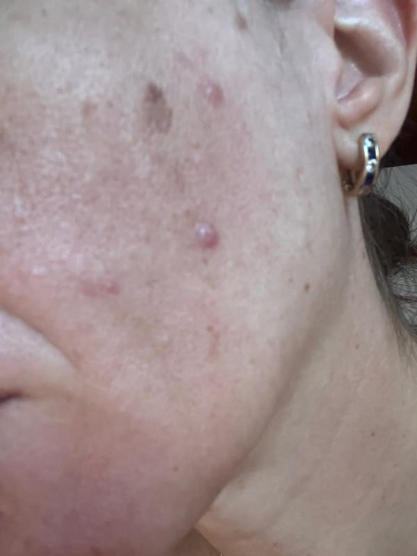 Beoordeling foto 1.