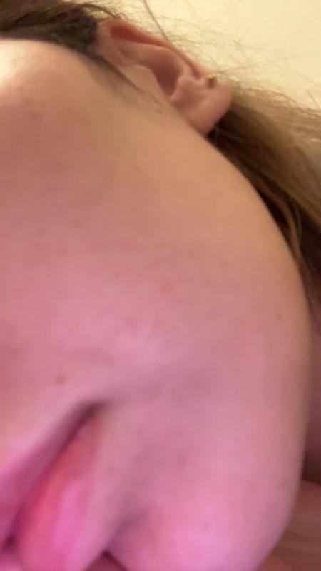 Beoordeling foto 1.