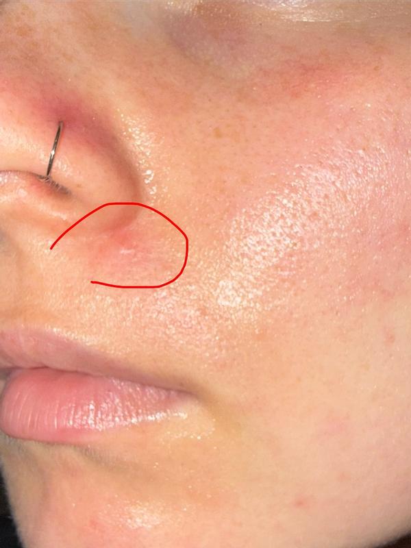 Beoordeling foto 1.