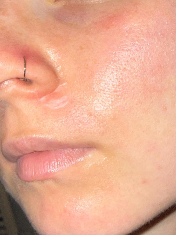 Beoordeling foto 2.