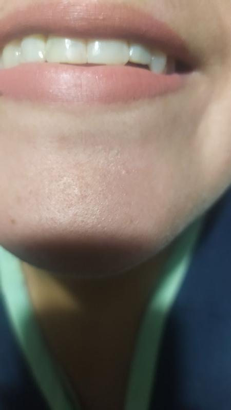 Review Thumbnail Image 0 374768716