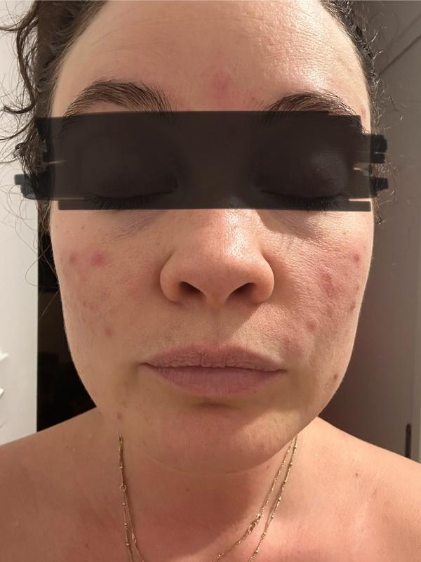 Review Thumbnail Image 0 374436846